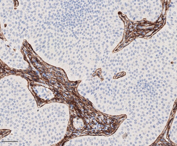 Microscope image of a stained lymph node