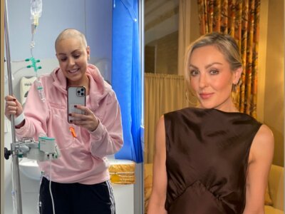 A composite photo of Amy Dowden from the This Is Me social media campaign, featuring a photo of her during breast cancer treatment and one of her post-treatment.