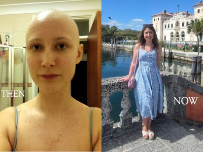 2 photos from Instagram. On the left, a woman with shaved head during cancer treatment with the caption "Then". On the right, a woman with long hair, smiling on a bridge over a canal, with the caption "Now"