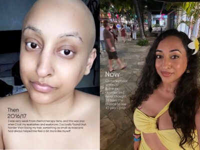 2 photos from Instagram. On the left, a woman with shaved head during cancer treatment with the caption "Then, 2016/17". On the right, a woman with long hair, smiling on holiday in Hawaii, with the caption "# This Is Me Now"